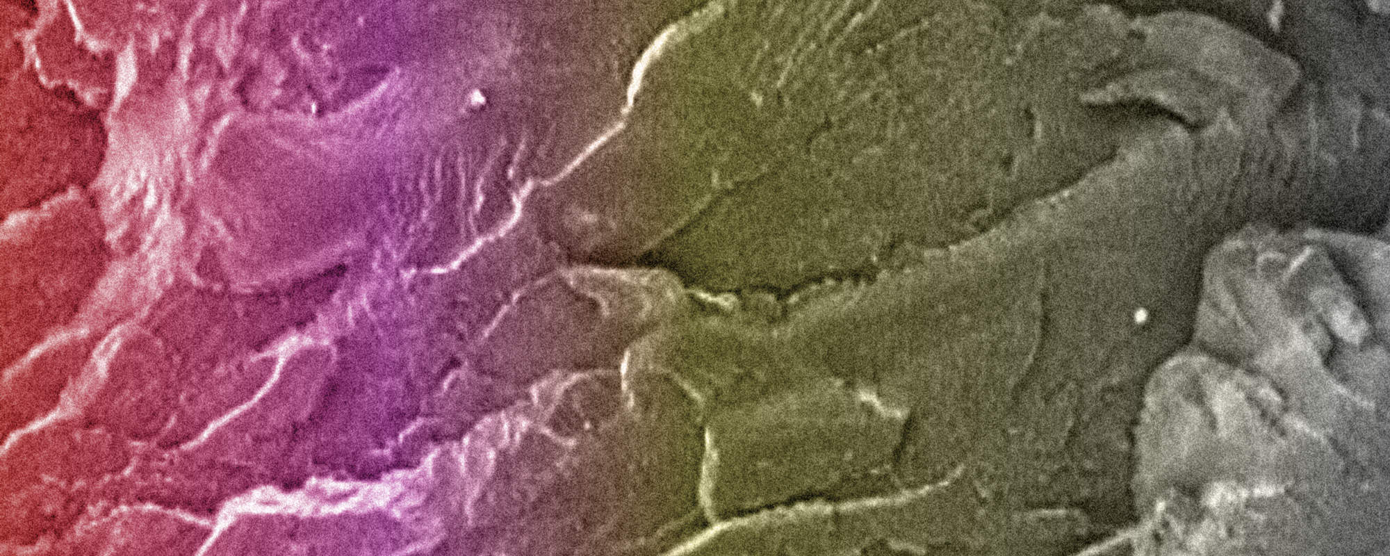 Kwas Polilaktydowy (PLA) – Wszechstronny Biopolimer Przyszłości